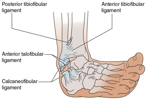 Ankle Instability | Podiatrist | NQ Foot & Ankle Centre | Townsville ...